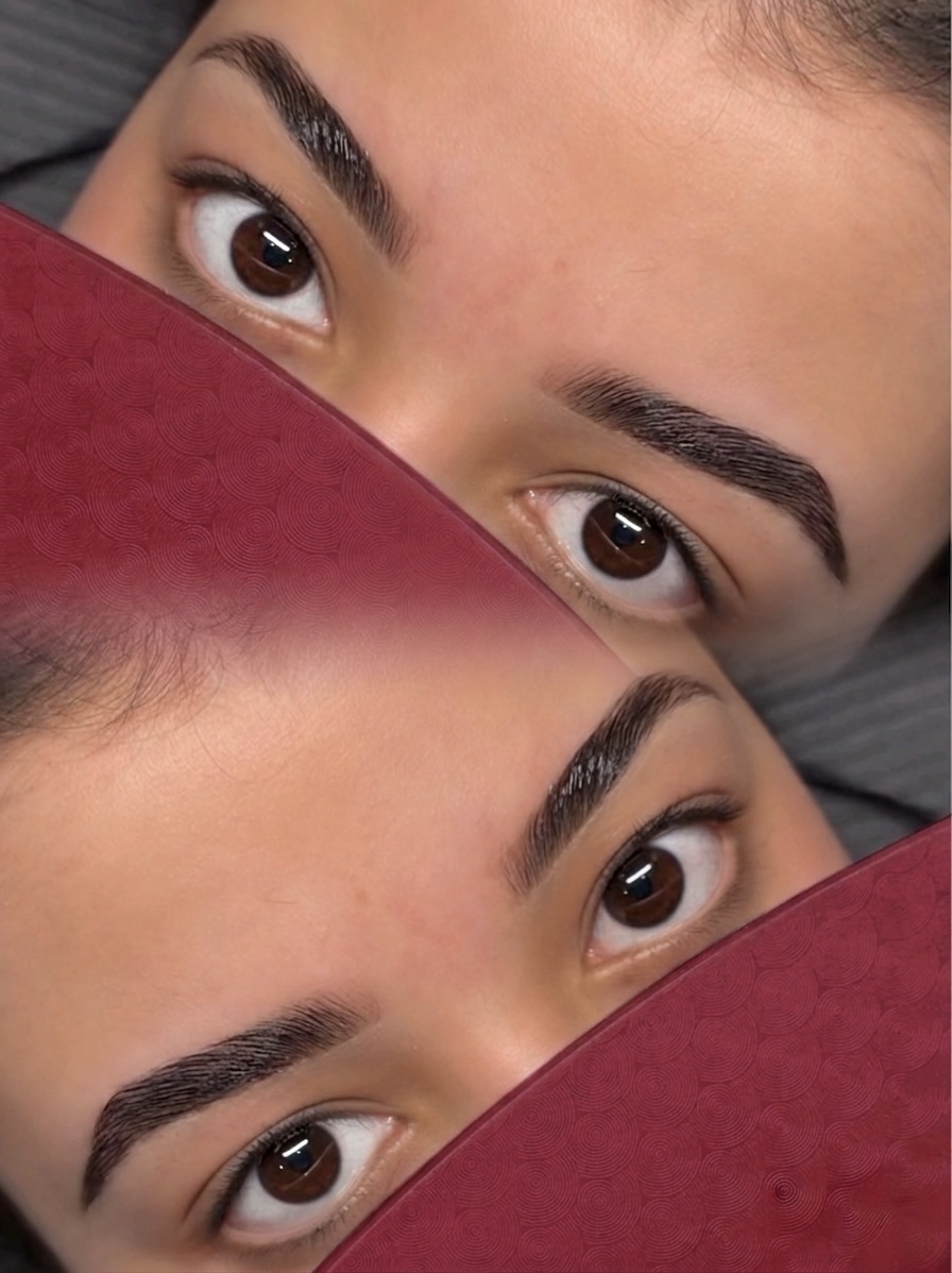 Brow results