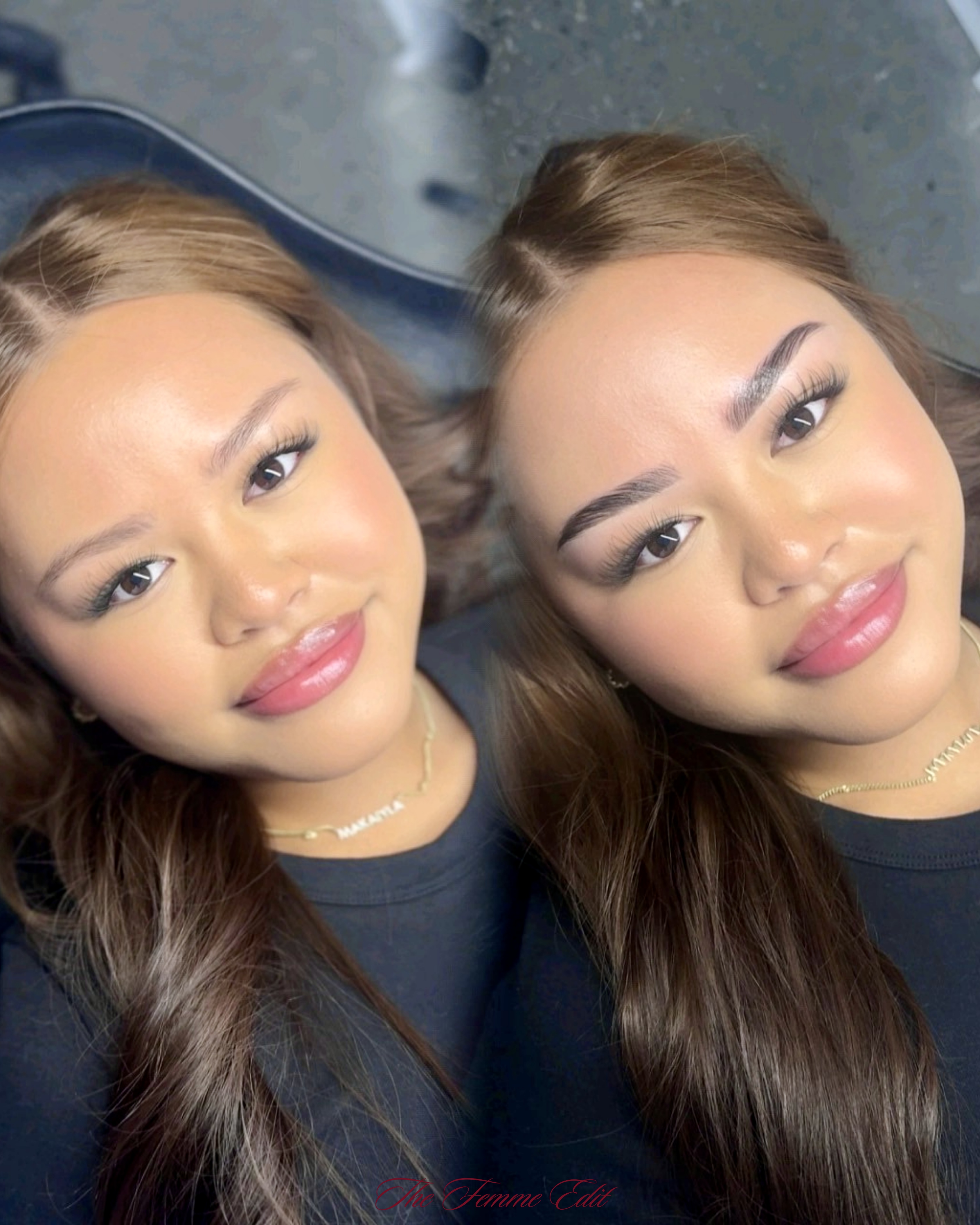 Brow results